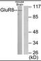 Glutamate Metabotropic Receptor 8 antibody, orb95583, Biorbyt, Western Blot image 