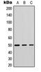 Phospholipase D Family Member 4 antibody, MBS8227575, MyBioSource, Western Blot image 