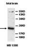 Rac Family Small GTPase 1 antibody, orb77660, Biorbyt, Western Blot image 