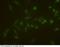 Fms Related Tyrosine Kinase 1 antibody, 10136-MM03, Sino Biological, Immunohistochemistry paraffin image 