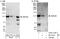 Zinc Finger Protein 281 antibody, A303-118A, Bethyl Labs, Immunoprecipitation image 
