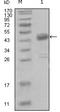 Discoidin Domain Receptor Tyrosine Kinase 1 antibody, M00905, Boster Biological Technology, Western Blot image 