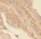 Zinc finger protein GLI1 antibody, PB9108, Boster Biological Technology, Immunohistochemistry frozen image 