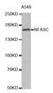 NFASC antibody, A04015, Boster Biological Technology, Western Blot image 
