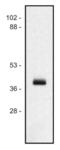 Major Histocompatibility Complex, Class I, A antibody, LS-C45854, Lifespan Biosciences, Western Blot image 