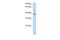 Nudix Hydrolase 13 antibody, GTX46192, GeneTex, Western Blot image 