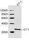 Cardiotrophin-1 antibody, LS-C203223, Lifespan Biosciences, Western Blot image 
