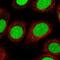 DNA repair protein complementing XP-C cells antibody, NBP2-38261, Novus Biologicals, Immunofluorescence image 