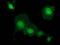 Potassium Channel Tetramerization Domain Containing 14 antibody, MA5-25447, Invitrogen Antibodies, Immunocytochemistry image 