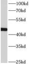 Actin Like 7B antibody, FNab00120, FineTest, Western Blot image 