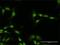 Phosphatidylinositol 4-kinase type 2-alpha antibody, H00055361-D01P, Novus Biologicals, Immunofluorescence image 