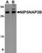 Nipsnap Homolog 3B antibody, 4957, ProSci, Western Blot image 