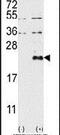 Dual specificity protein phosphatase 13 antibody, PA5-15563, Invitrogen Antibodies, Western Blot image 