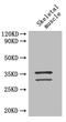 TNNT2 antibody, A52106-100, Epigentek, Western Blot image 