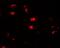 Ubiquitin Specific Peptidase 25 antibody, GTX17216, GeneTex, Immunohistochemistry paraffin image 
