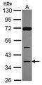 Decapping Enzyme, Scavenger antibody, GTX115870, GeneTex, Western Blot image 