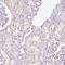 Synaptonemal Complex Central Element Protein 2 antibody, HPA042080, Atlas Antibodies, Immunohistochemistry paraffin image 