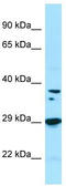 Protein Phosphatase 1 Catalytic Subunit Beta antibody, TA338252, Origene, Western Blot image 