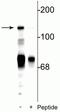 NMDAR2C antibody, P07769-1, Boster Biological Technology, Western Blot image 