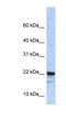 KIAA0040 antibody, NBP1-91623, Novus Biologicals, Western Blot image 