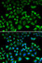 NHL Repeat Containing E3 Ubiquitin Protein Ligase 1 antibody, 22-395, ProSci, Immunofluorescence image 