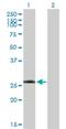 Leucine Rich Repeat Kinase 1 antibody, H00079705-B01P, Novus Biologicals, Western Blot image 
