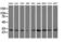 Capping Actin Protein Of Muscle Z-Line Subunit Alpha 1 antibody, LS-C115163, Lifespan Biosciences, Western Blot image 