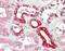 Bcl-2-related ovarian killer protein antibody, NBP2-69987, Novus Biologicals, Immunohistochemistry paraffin image 