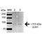 Unc-51 Like Autophagy Activating Kinase 1 antibody, LS-C775716, Lifespan Biosciences, Western Blot image 
