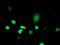 ATR Interacting Protein antibody, MA5-25944, Invitrogen Antibodies, Immunocytochemistry image 