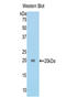 Tenascin C antibody, LS-C301419, Lifespan Biosciences, Western Blot image 
