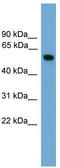 Pyruvate Kinase M1/2 antibody, TA344600, Origene, Western Blot image 