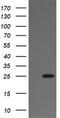 Vesicle Transport Through Interaction With T-SNAREs 1A antibody, TA505824AM, Origene, Western Blot image 