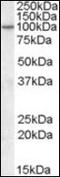 Arf-GAP with GTPase, ANK repeat and PH domain-containing protein 2 antibody, orb89655, Biorbyt, Western Blot image 