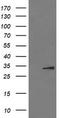 Interleukin 1 Beta antibody, TA506443S, Origene, Western Blot image 