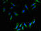 CKLF Like MARVEL Transmembrane Domain Containing 2 antibody, orb354411, Biorbyt, Immunofluorescence image 
