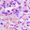 PDGF-AA antibody, LS-C352639, Lifespan Biosciences, Immunohistochemistry paraffin image 