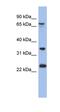 TBC1 Domain Family Member 25 antibody, orb326095, Biorbyt, Western Blot image 