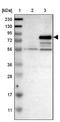 ATPase H+ Transporting V0 Subunit A4 antibody, NBP1-89330, Novus Biologicals, Western Blot image 