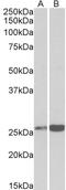 Peroxiredoxin 6 antibody, LS-C305854, Lifespan Biosciences, Western Blot image 