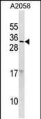 Ribonuclease A Family Member 9 (Inactive) antibody, PA5-49255, Invitrogen Antibodies, Western Blot image 