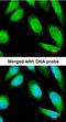 B-CK antibody, orb73963, Biorbyt, Immunofluorescence image 