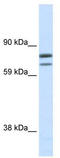 Zinc Finger Protein, FOG Family Member 1 antibody, TA341827, Origene, Western Blot image 