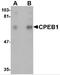 Cytoplasmic polyadenylation element-binding protein 1 antibody, 4687, ProSci Inc, Western Blot image 