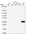 Interferon gamma receptor 1 antibody, HPA063871, Atlas Antibodies, Western Blot image 