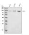 Ubiquitin Like With PHD And Ring Finger Domains 2 antibody, M06294-1, Boster Biological Technology, Western Blot image 