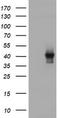 Tubulin Folding Cofactor C antibody, TA504686, Origene, Western Blot image 