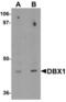 Homeobox protein DBX1 antibody, LS-C144412, Lifespan Biosciences, Western Blot image 