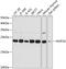 NOP16 Nucleolar Protein antibody, GTX66230, GeneTex, Western Blot image 