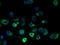 Family With Sequence Similarity 156 Member B antibody, A59038-100, Epigentek, Immunofluorescence image 
